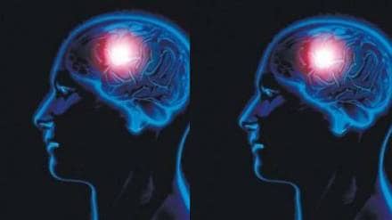 Brain Tumour Signs and symptoms