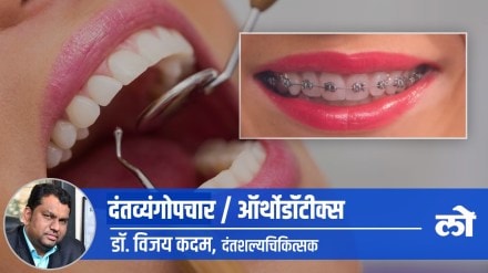 orthodontist dental treatment