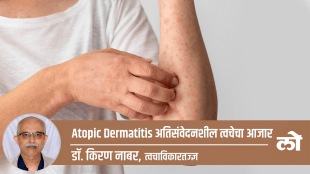atopic dermatitis sensetive skin disease