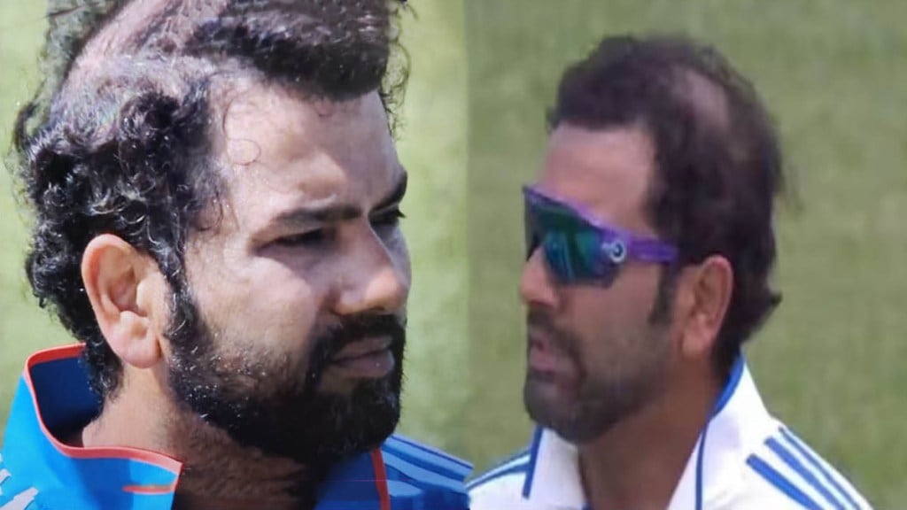 Rohit Sharma's hair fell due to worry about Leadership Pressure of fans gave Hair transplant advice Rohit Sharma's hair fell due to worry about Leadership Pressure of fans gave Hair transplant advice