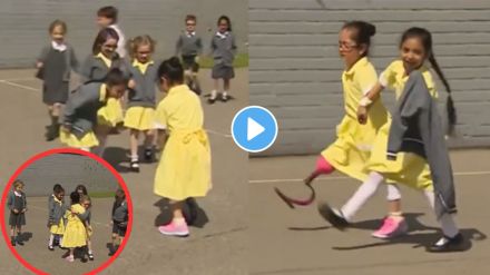 Prosthetic leg viral video