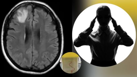 Womans Brain Live Worm Womans Brain Live Worm