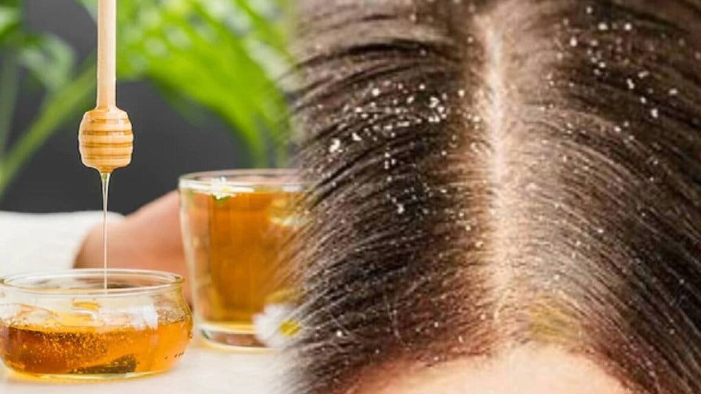 home made tips for dandruff remove