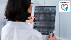 Diabetes and X-rays : एक्स-रेद्वारे मधुमेहाचा धोका ओळखता येतो? वाचा, तज्ज्ञ काय सांगतायत ….