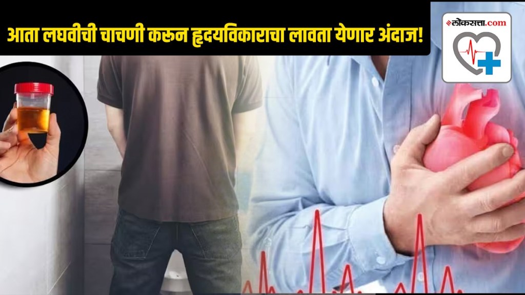 Now a simple urine test can predict heart disease and treat it early