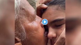 Eye Flu Viral Video On Instagram