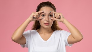 how to get rid of dark circles home remedies