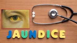 नागपुरात कावीळचा धोका वाढला, कोणत्या भागात किती रुग्ण पाहा…