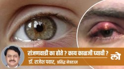 Health Special: रांजणवाडी का होते? काय काळजी घ्यावी?