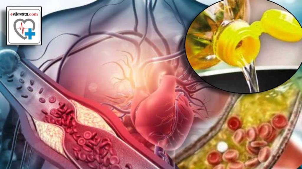 Can Coconut oil Boost Good Cholesterol and boost your heart health How much Oil should be Eaten Daily Health Expert News