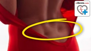 Venus Holes On Your back indicative of good health...