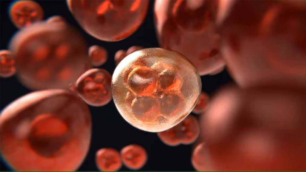 accurate diagnosis of gallbladder cancer