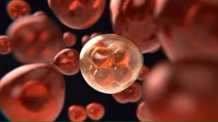 accurate diagnosis of gallbladder cancer