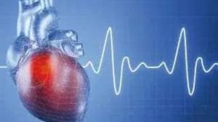 heart transplant