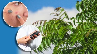 neem-leaves-health-benefits