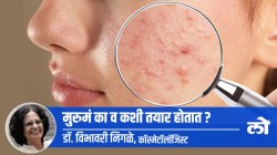 Health Special: पिंपल्स का व कशी तयार होतात?