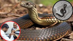 MP News went to doctor with snake