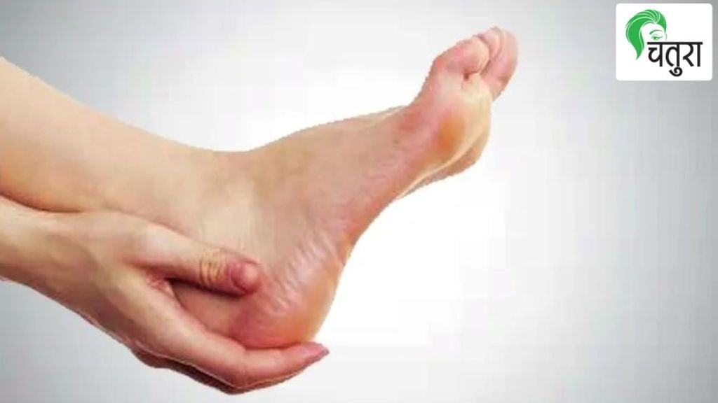 crack heels
