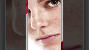 Do you suffer from pigmentation Learn from the experts