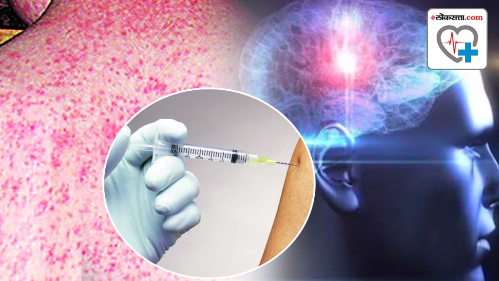 Measles Vaccination