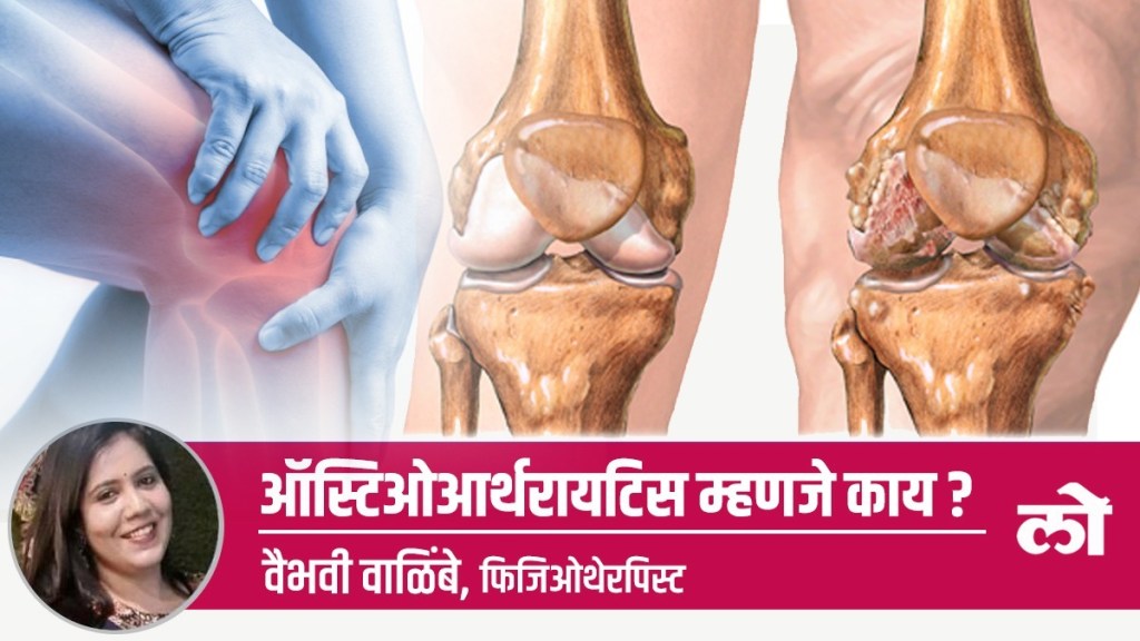 What is osteoarthritis What is osteoarthritis
