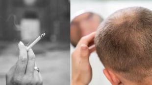 Smoking and Hair Fall
