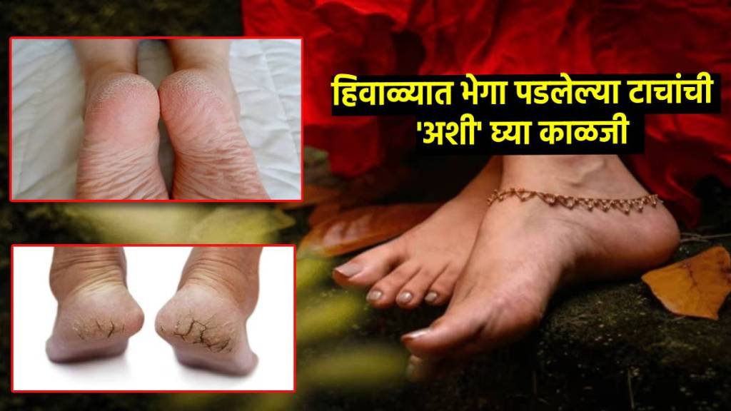 skin care tip for winter crack heels care tips home remedies in winter