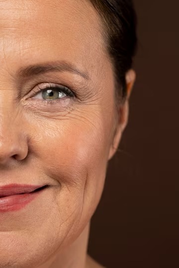 wrinkles-on-face