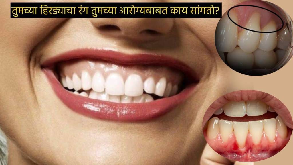 Red Pink Blue Color Of Gums Indicate Health Blood And Oxygen Supply in Body Heart Conditions What Does Your Gum Tell Check Red Pink Blue Color Of Gums Indicate Health Blood And Oxygen Supply in Body Heart Conditions What Does Your Gum Tell Check