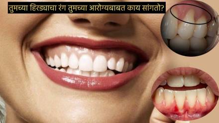 Red Pink Blue Color Of Gums Indicate Health Blood And Oxygen Supply in Body Heart Conditions What Does Your Gum Tell Check