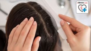 Dandruff in Winter