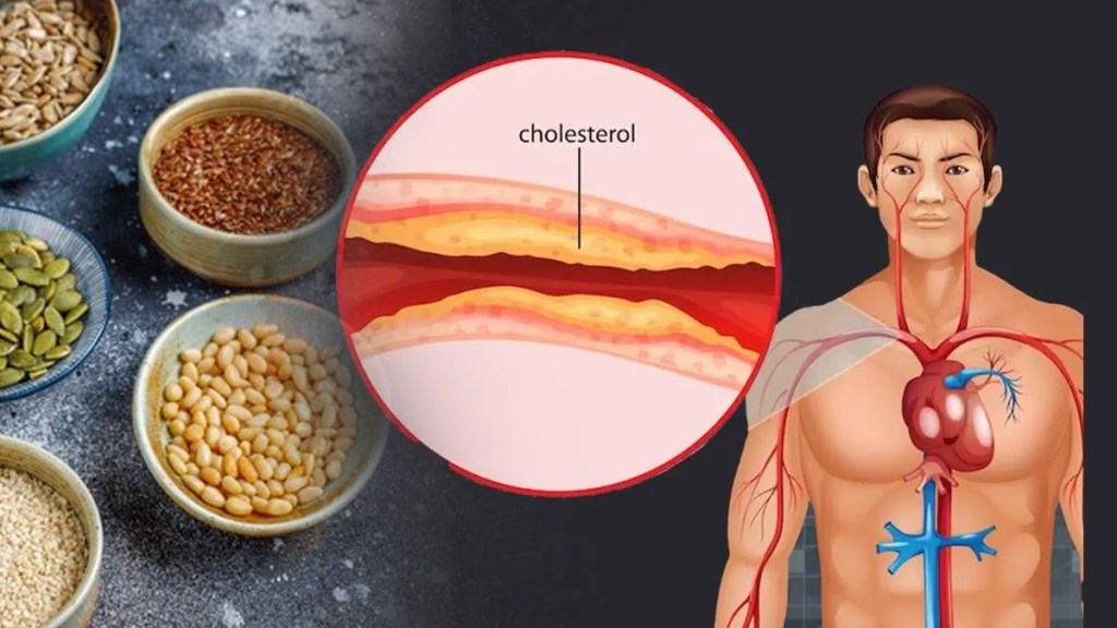Flaxseeds Reduced Bad Cholesterol Flaxseeds Reduced Bad Cholesterol