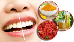 teeth-whitening-home-remedies
