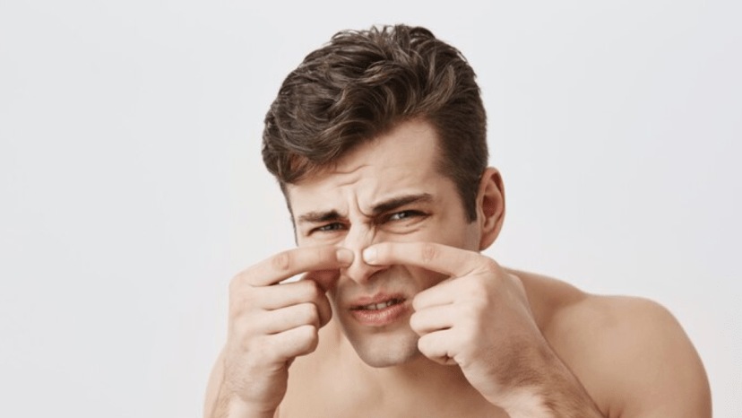 Best Home Remedies To Get Rid Of Black Rids At Nose