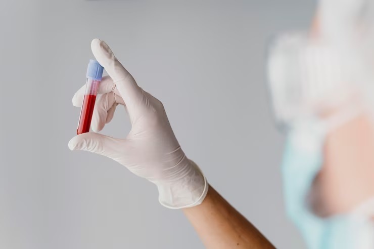 blood group compatibility for marriage can people do marriage in the same blood group
