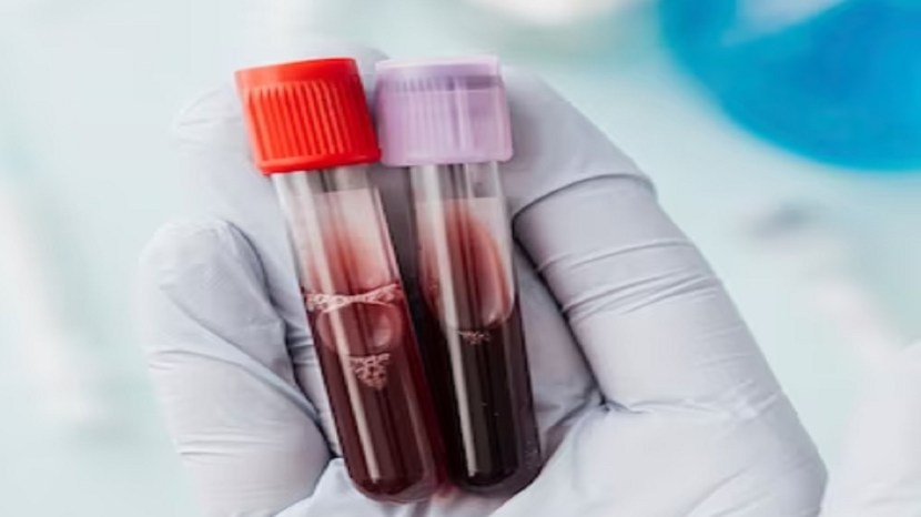 blood group compatibility for marriage can people do marriage in the same blood group