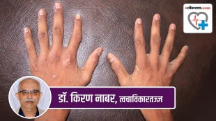 scabies marathi news, scabies symptoms marathi news,