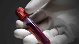 mumbai shatabdi hospital marathi news, blood test stopped shatabdi hospital marathi news