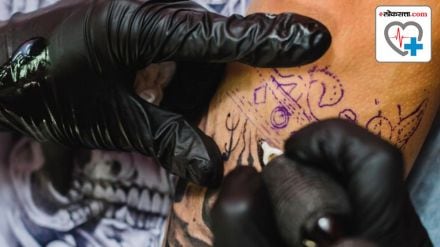 What precautions should be taken before and after tattoo removal know the important things for Experts