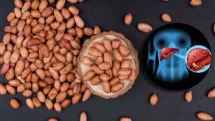 diy health peanuts risks can eating peanust in excess quantity damage the live read doctor answer
