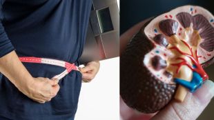 this-habits-can-cause-kidney-stone