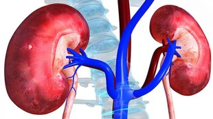 pune, maharashtra, four hundred, kidney transplant, waiting list patients, dying,