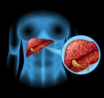 diy health peanuts risks can eating peanust in excess quantity damage the live read doctor answer