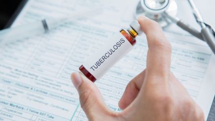 11 thousands Nikshay Mitra adopt 19 thousands tuberculosis patients