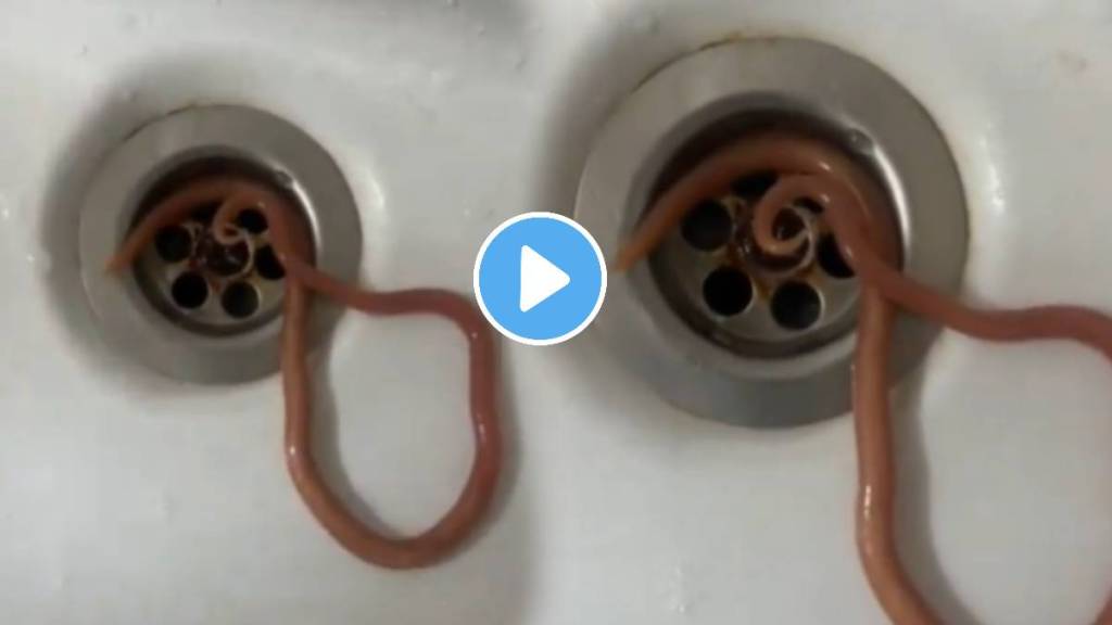 Viral video: Man vomits live worm after complaining of abdominal pain