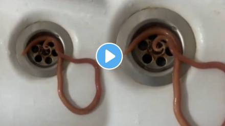 Viral video: Man vomits live worm after complaining of abdominal pain