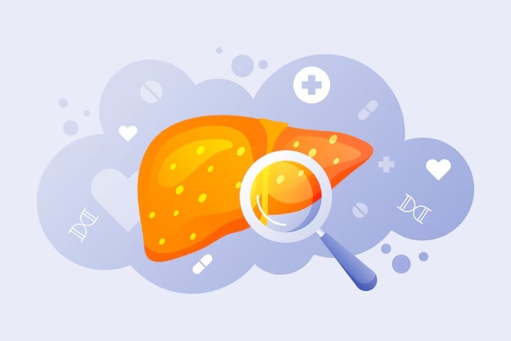 fatty-liver-symptoms 