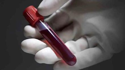 minors Both blood samples revealed no alcohol