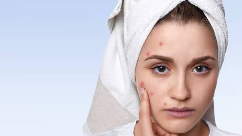 Benefits of Rubbing Banana Peels on Face