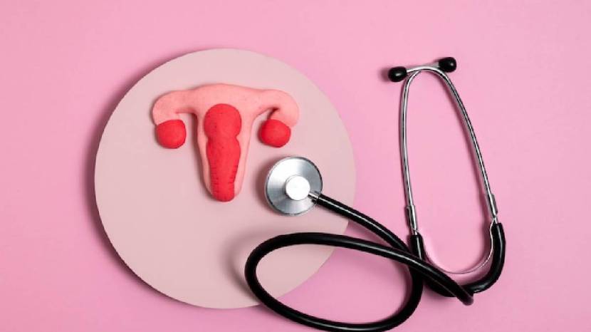 Symptoms of Ovarian Cancer